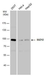 SUZ12 Antibody in Western Blot (WB)