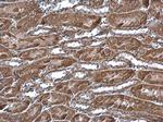 MTCH2 Polyclonal Antibody