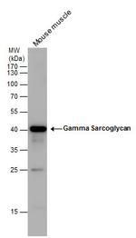 SGCG Polyclonal Antibody