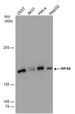 KIF4A Polyclonal Antibody