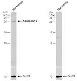 Aquaporin 2 Polyclonal Antibody
