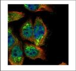 SH2B1 Polyclonal Antibody