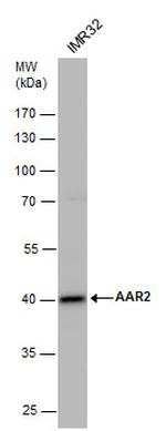 AAR2 Polyclonal Antibody
