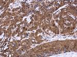 TES Polyclonal Antibody