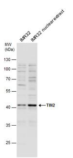TIN2 Polyclonal Antibody