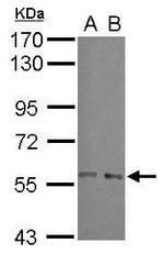 ARFGAP3 Polyclonal Antibody