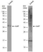 LAT Antibody in Western Blot (WB)
