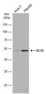 GLS2 Polyclonal Antibody