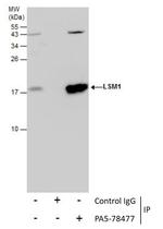 LSM1 Antibody in Immunoprecipitation (IP)