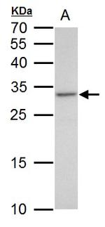 VENTX Polyclonal Antibody