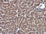 SSU72 Polyclonal Antibody