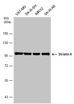 STRN4 Antibody in Western Blot (WB)