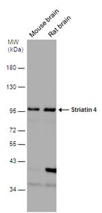 STRN4 Antibody in Western Blot (WB)