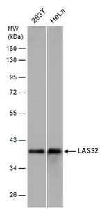 Lass2 Antibody in Western Blot (WB)