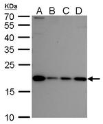 NIP7 Antibody in Western Blot (WB)