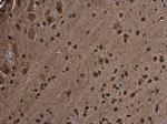 RGS14 Polyclonal Antibody