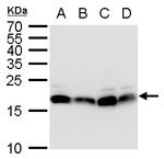POLE3 Polyclonal Antibody