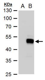 SOX18 Polyclonal Antibody