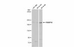 PARP14 Polyclonal Antibody