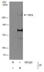TET2 Antibody in Immunoprecipitation (IP)