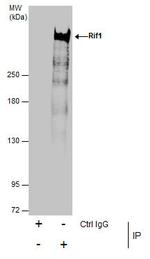 RIF1 Antibody in Immunoprecipitation (IP)