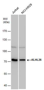 KLHL26 Polyclonal Antibody