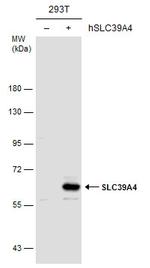 SLC39A4 Antibody in Western Blot (WB)
