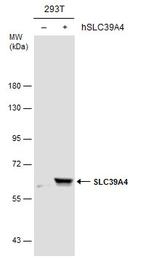 SLC39A4 Polyclonal Antibody
