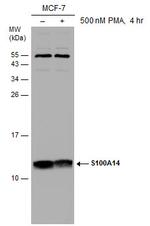 S100A14 Polyclonal Antibody