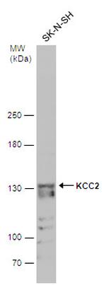 KCC2 Antibody in Western Blot (WB)