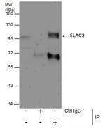 ELAC2 Antibody in Immunoprecipitation (IP)