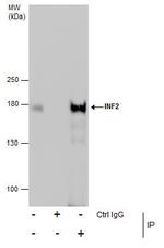INF2 Antibody in Immunoprecipitation (IP)