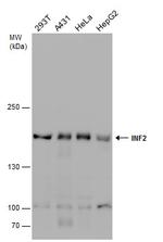 INF2 Polyclonal Antibody