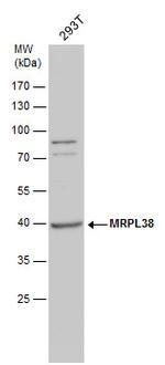 MRPL38 Polyclonal Antibody