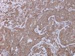 UPF3B Polyclonal Antibody