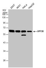 UPF3B Antibody in Western Blot (WB)