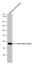 PNLIP Antibody in Western Blot (WB)