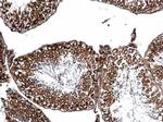 PAK4 Antibody in Immunohistochemistry (Paraffin) (IHC (P))