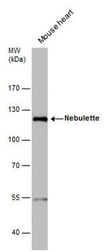 NEBL Polyclonal Antibody