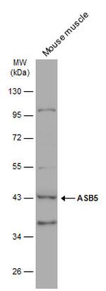 ASB5 Polyclonal Antibody