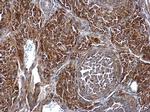 SMPD4 Antibody in Immunohistochemistry (Paraffin) (IHC (P))