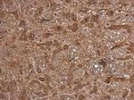 FSD1 Antibody in Immunohistochemistry (Paraffin) (IHC (P))