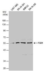FSD1 Antibody in Western Blot (WB)