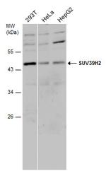 SUV39H2 Polyclonal Antibody