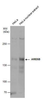 ARID5B Polyclonal Antibody