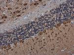 RAP1GAP Antibody in Immunohistochemistry (Paraffin) (IHC (P))