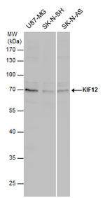 KIF12 Polyclonal Antibody