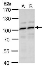 MYSM1 Polyclonal Antibody
