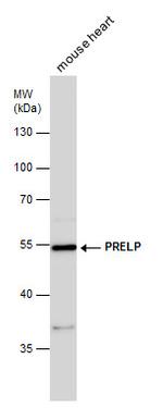 PRELP Antibody in Western Blot (WB)