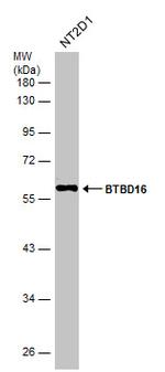 BTBD16 Polyclonal Antibody